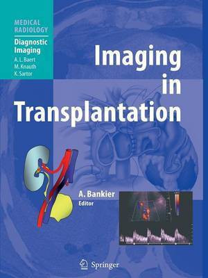 Imaging in Transplantation(English, Paperback, unknown)