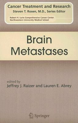 Brain Metastases(English, Hardcover, unknown)