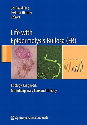 Life with Epidermolysis Bullosa (EB)(English, Paperback, unknown)
