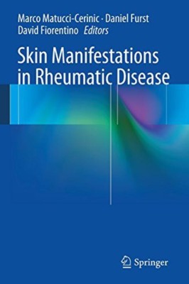 Skin Manifestations in Rheumatic Disease(English, Paperback, unknown)