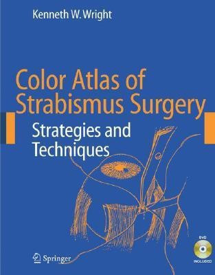 Color Atlas of Strabismus Surgery(English, Mixed media product, Wright Kenneth W.)