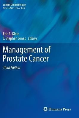 Management of Prostate Cancer(English, Hardcover, unknown)