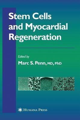 Stem Cells and Myocardial Regeneration(English, Hardcover, unknown)
