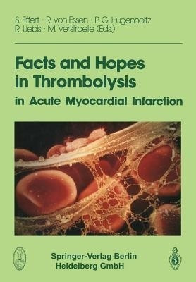 Facts and Hopes in Thrombolysis in Acute Myocardial Infarction(English, Paperback, unknown)