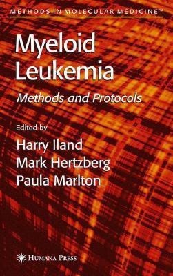 Myeloid Leukemia(English, Hardcover, unknown)