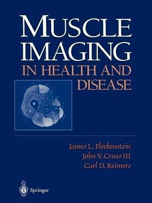 Muscle Imaging in Health and Disease(English, Paperback, unknown)