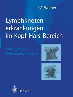 Lymphknotenerkrankungen im Kopf-Hals-Bereich(German, Paperback, Werner Jochen A.)