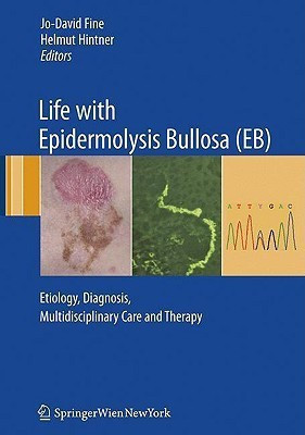 Life with Epidermolysis Bullosa (EB)(English, Hardcover, unknown)
