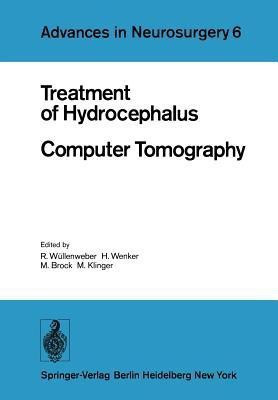 Treatment of Hydrocephalus Computer Tomography(English, Paperback, unknown)