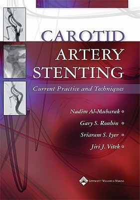 Carotid Artery Stenting(English, Hardcover, unknown)