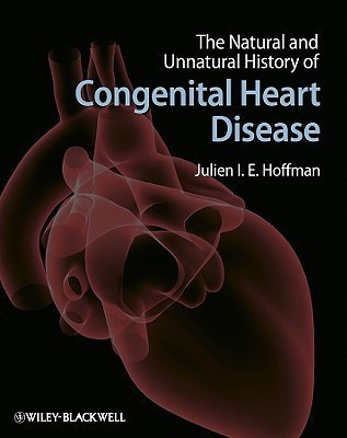 The Natural and Unnatural History of Congenital Heart Disease(English, Hardcover, unknown)