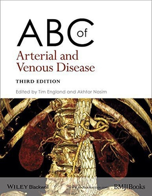 ABC of Arterial and Venous Disease(English, Paperback, unknown)