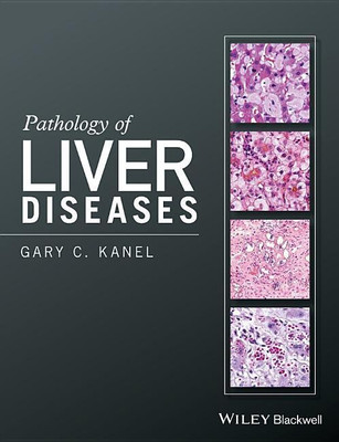 Pathology of Liver Diseases(English, Hardcover, Kanel Gary C.)
