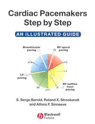Cardiac Pacemakers Step by Step(English, Paperback, Barold S. Serge)