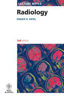 Lecture Notes: Radiology(English, Paperback, Patel Pradip R.)