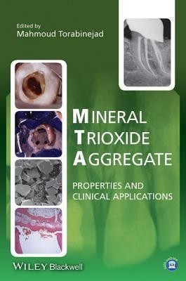 Mineral Trioxide Aggregate(English, Hardcover, Torabinejad Mahmoud)