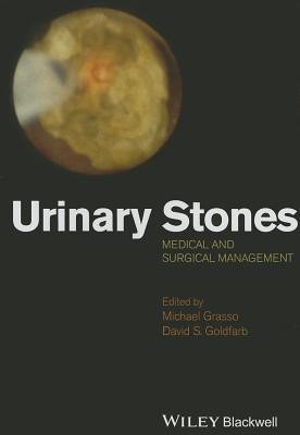 Urinary Stones(English, Hardcover, unknown)