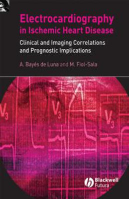 Electrocardiography in Ischemic Heart Disease(English, Hardcover, Bayes de Luna Antoni)
