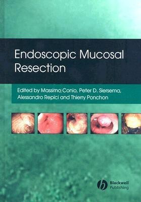 Endoscopic Mucosal Resection(English, Hardcover, unknown)