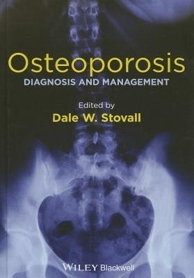 Osteoporosis(English, Hardcover, unknown)