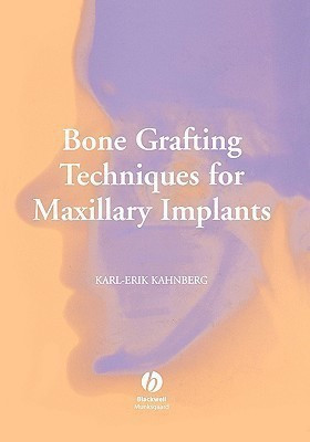 Bone Grafting Techniques for Maxillary Implants(English, Hardcover, Kahnberg Karl-Erik)