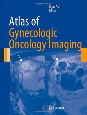 Atlas of Gynecologic Oncology Imaging(English, Hardcover, unknown)