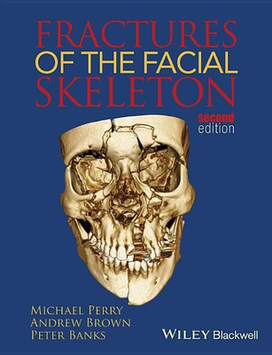 Fractures of the Facial Skeleton(English, Paperback, Perry Michael)