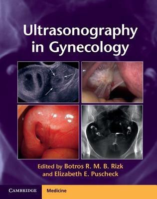 Ultrasonography in Gynecology(English, Hardcover, unknown)