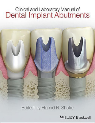 Clinical and Laboratory Manual of Dental Implant Abutments(English, Hardcover, Shafie Hamid R.)
