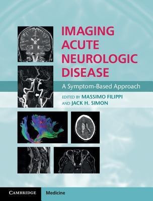 Imaging Acute Neurologic Disease(English, Hardcover, unknown)