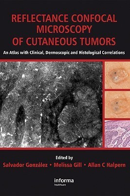 Reflectance Confocal Microscopy of Cutaneous Tumors(English, Hardcover, unknown)