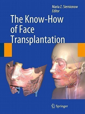 The Know-How of Face Transplantation(English, Hardcover, unknown)