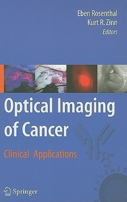 Optical Imaging of Cancer(English, Hardcover, unknown)