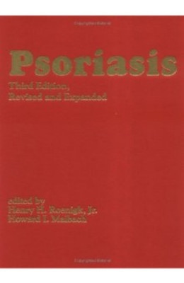 Psoriasis, Third Edition,, Third Edition(English, Hardcover, unknown)