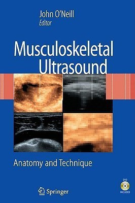 Musculoskeletal Ultrasound(English, Mixed media product, unknown)