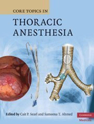 Core Topics in Thoracic Anesthesia(English, Hardcover, unknown)