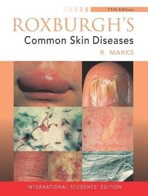 Roxburgh's Common Skin Diseases, 17Ed(English, Paperback, Marks Ronald)