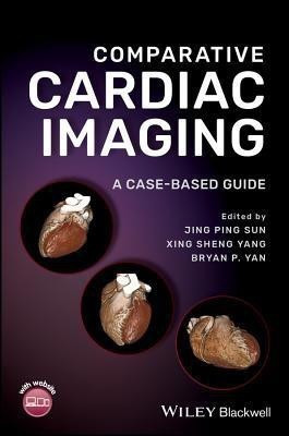Comparative Cardiac Imaging(English, Hardcover, unknown)