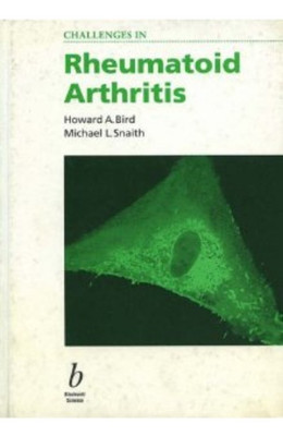 Questions and Uncertainties in Rheumatoid Arthritis(English, Paperback, Bird Howard A.)