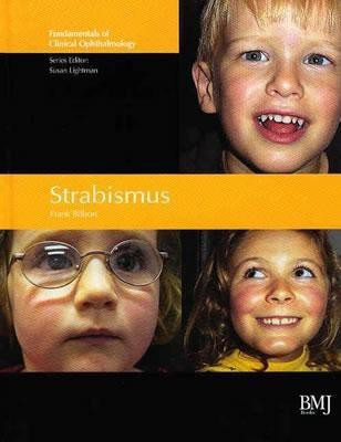 Strasbismus(English, Hardcover, Billson Frank)