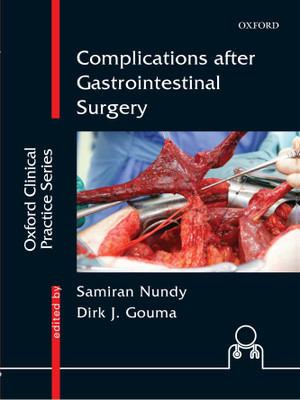 Complications after Gastrointestinal Surgery(English, Hardcover, unknown)