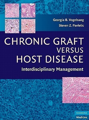 Chronic Graft Versus Host Disease(English, Hardcover, unknown)
