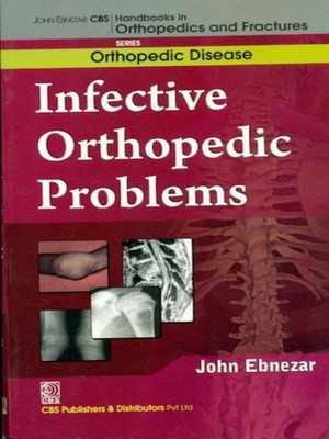 John Ebnezar CBS Handbooks in Orthopedics and Factures(English, Paperback, Ebnezar John)