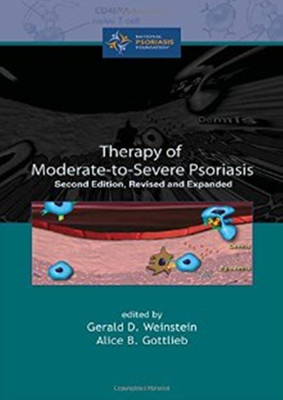 Therapy of Moderate-to-Severe-Psoriasis, Second Edition(English, Hardcover, unknown)