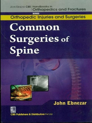John Ebnezar CBS Handbooks in Orthopedics and Factures(English, Paperback, Ebnezar John)