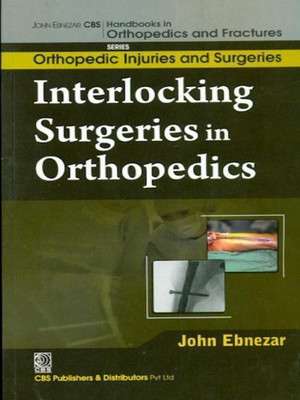 John Ebnezar CBS Handbooks in Orthopedics and Factures(English, Paperback, Ebnezar John)