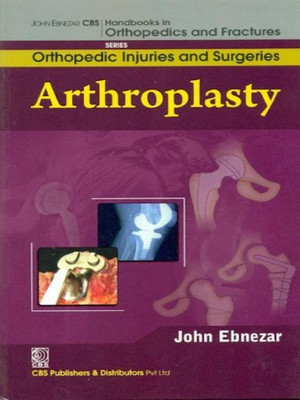 John Ebnezar CBS Handbooks in Orthopedics and Factures(English, Paperback, Ebnezar John)