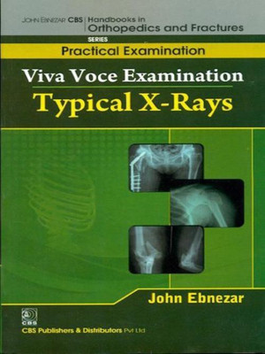 John Ebnezar Cbs Handbooks in Orthopedics and Factures:Practical Exami(English, Paperback, Ebnezar John)