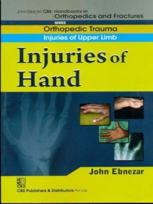 John Ebnezar CBS Handbooks in Orthopedics and Factures(English, Paperback, Ebnezar John)