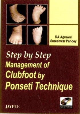 Step by Step Management of Equinus by Ilizarov(English, Mixed media product, unknown)